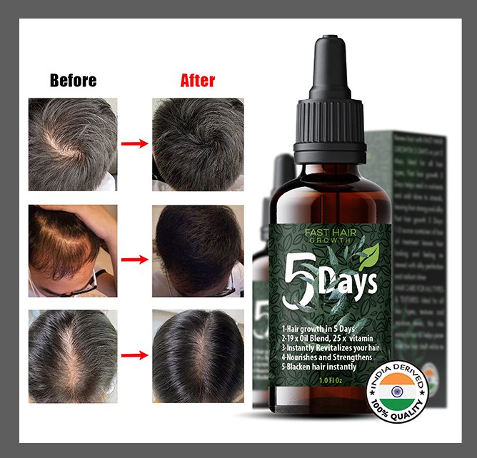 Fast hair growth 5 days oil